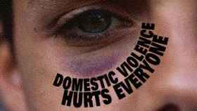 Close-up of a man’s right eye with a purple highlight under it, resembling a dark circle. Text overlay reads: ‘Domestic violence hurts everyone.’”